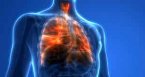 lung-injury-CDC 電子煙
